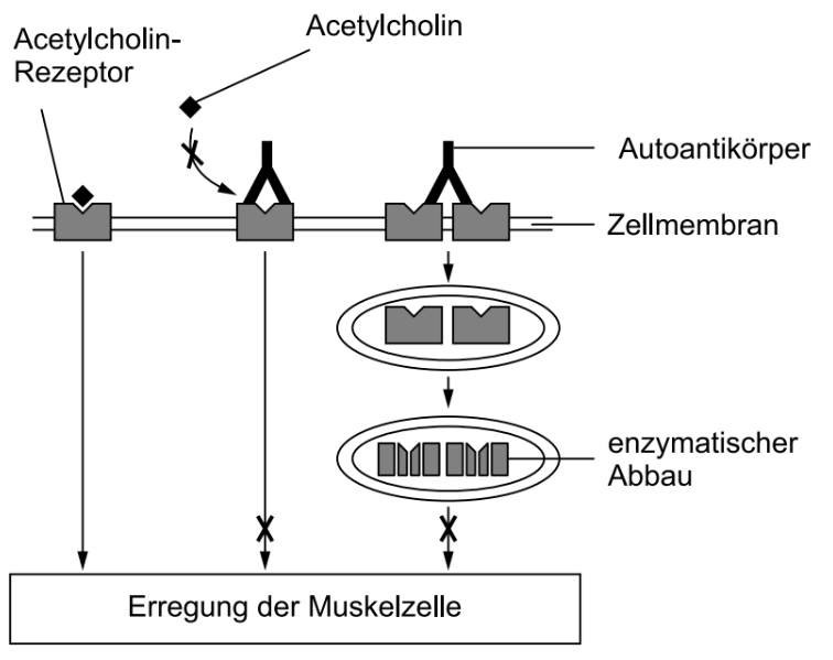Schema zu Acetylcholin-Rezeptoren, Autoantikörpern und Muskelzell-Erregung